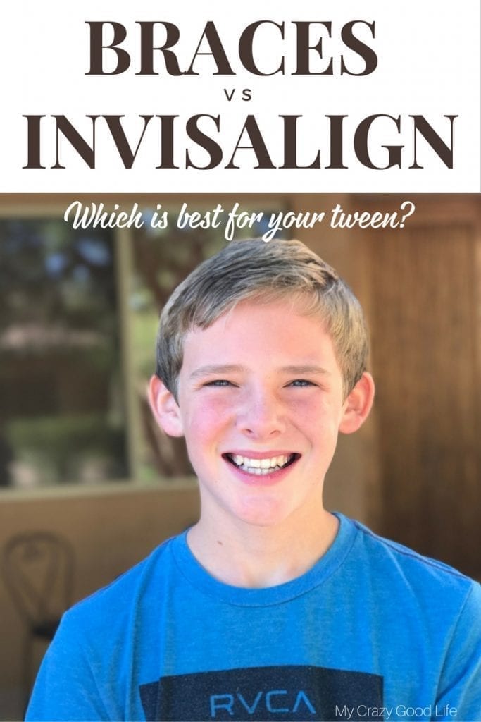 Invisalign vs Braces–which is better for your tween? I'm sharing our favorite things about Invisalign and why we love it for our tween!