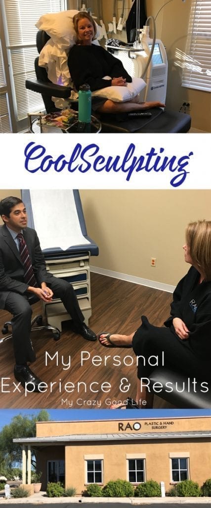 Thinking about trying CoolSculpting to target fat loss and tone up? I reviewed the process and am sharing my story and CoolSculpting results pictures today!
