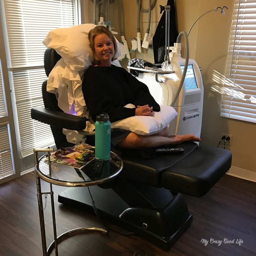 Thinking about trying CoolSculpting to target fat loss and tone up? I reviewed the process and results and am sharing my story and pictures today! 