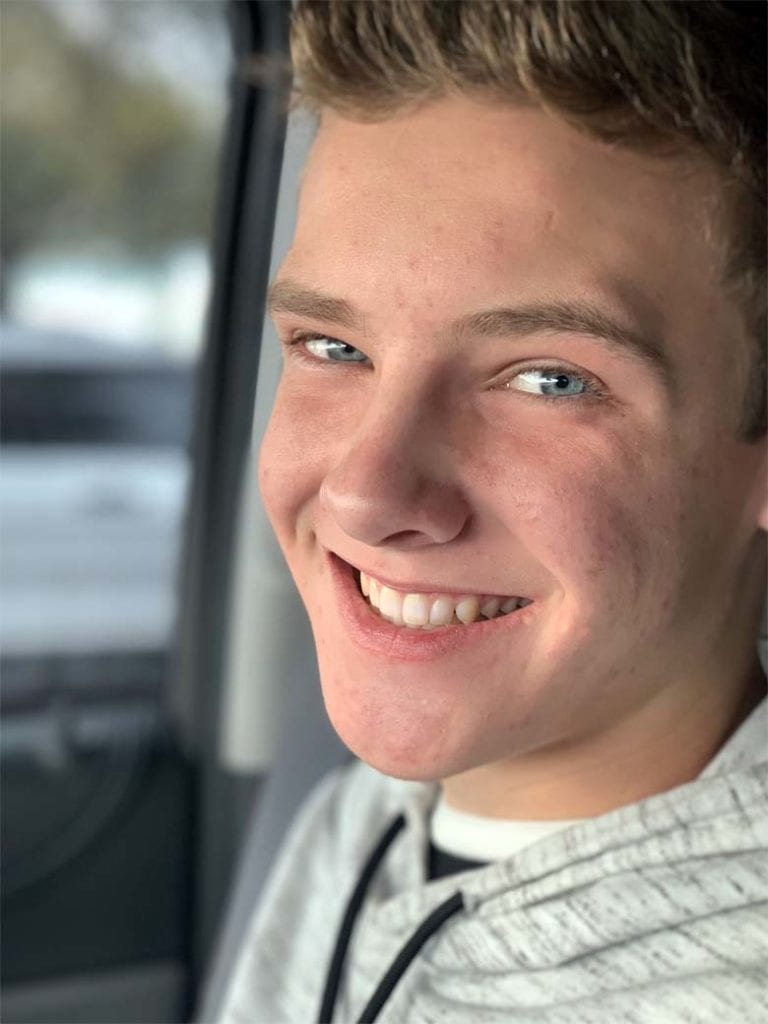 Jack's smile with completed invisalign treatment